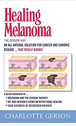Healing Melanoma Healing Melanoma